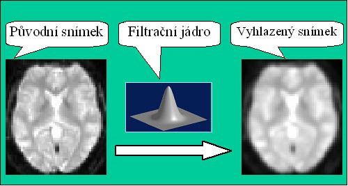 fMRI4_4.jpg