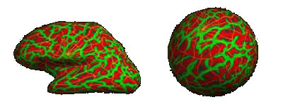 fMRI6_8.jpg